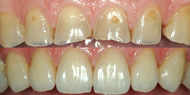 odontoiatria cosmetica protesi cosmetica